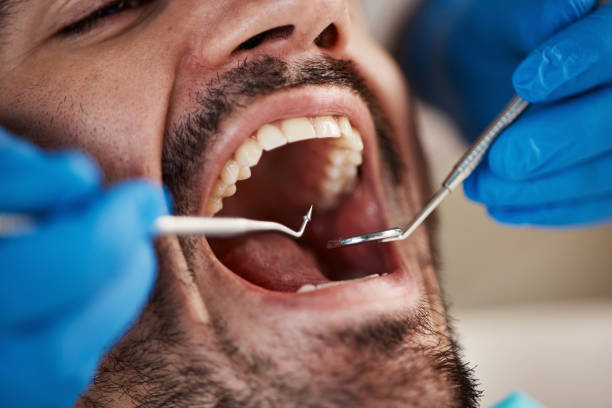 Best Emergency Dentist for Knocked-Out Tooth in Mulberry, NC